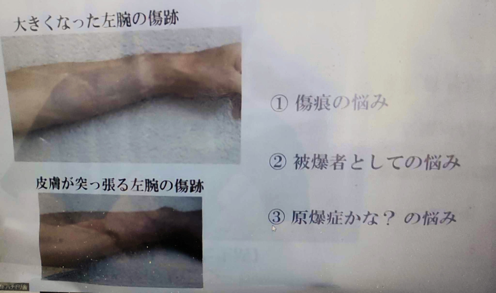 Okamoto-Injuries.jpg